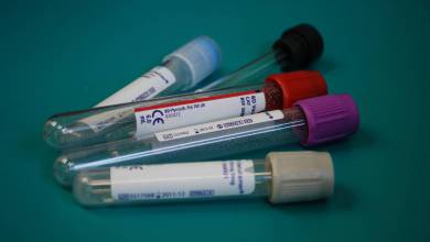 Coronavirus Testing