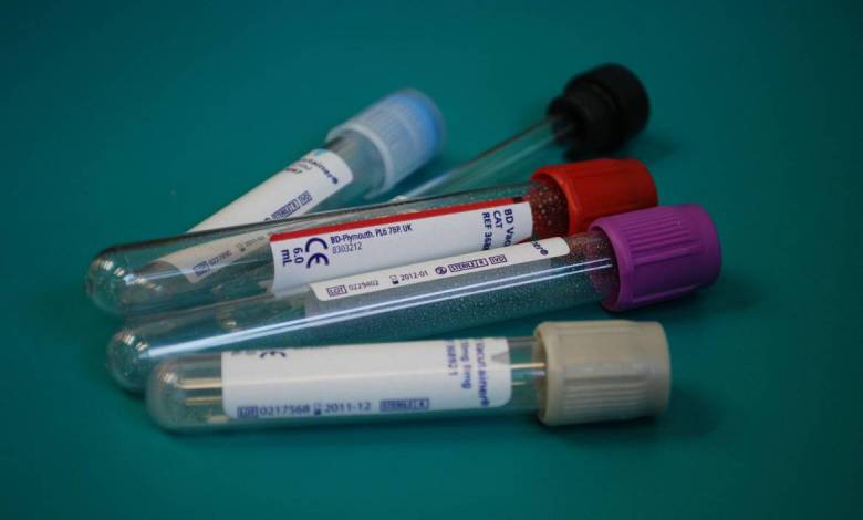 Monaco receives Rapid Antigen Tests